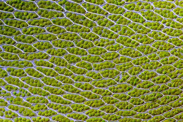 Chloroplasts visible in the cells of Bryum capillare