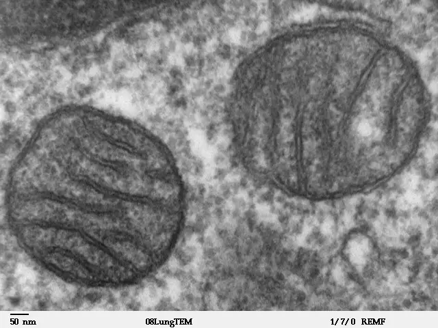 Two Mitochondria